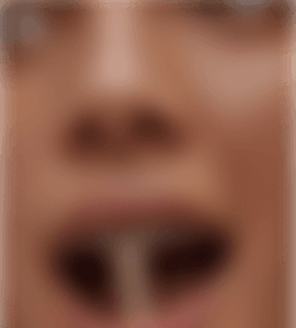 Instagram post blurred out