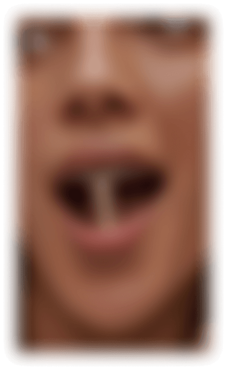Instagram post blurred out